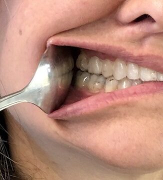 Use the spoon on your mouth right side to show your Invisalign on the right