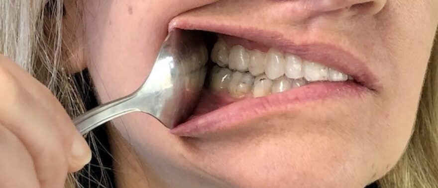 Use the spoon on your mouth right side to show your Invisalign on the right
