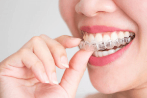 Bee Cave Orthodontics Invisalign for adults and kids in Austin