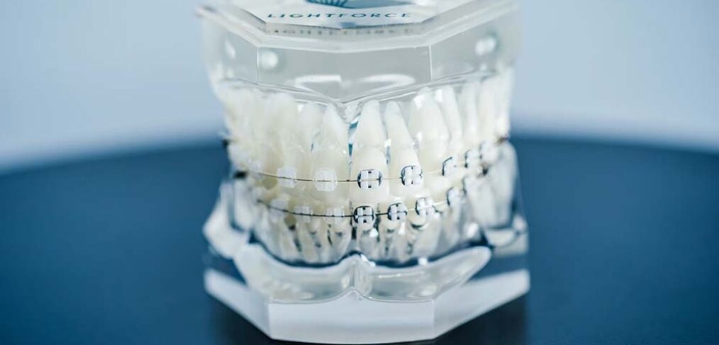 Lightforce braces beecaveortho.com