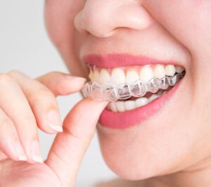 Bee Cave Orthodontics Invisalign for adults and kids in Austin