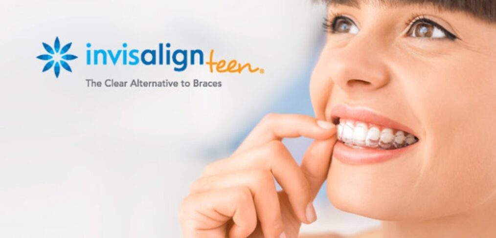 Invisalign for Your Teen